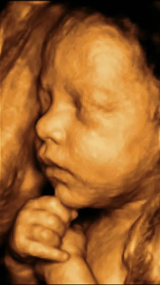 Ultrasound: before